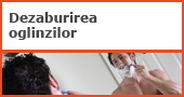 dezaburire oglinzi